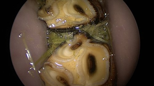 Diastema&#x27;s