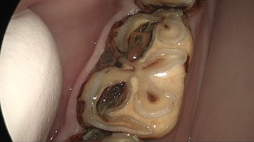 endodontie